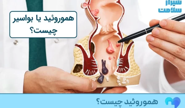 هموروئید یا بواسیر چیست؟