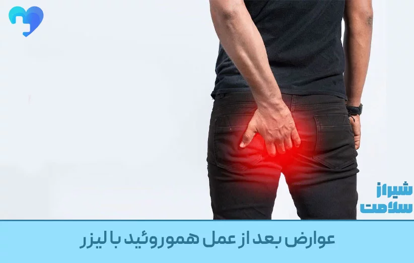 عوارض بعد از عمل هموروئید با لیزر عوارض بعد از عمل هموروئید با لیزر