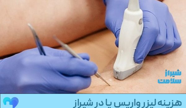 هزینه لیزر واریس پا در شیراز