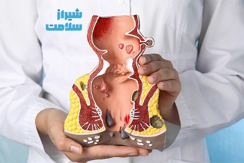 بهترین متخصص بواسیر در شیراز