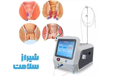 جراحی لیزری بواسیر در شیراز