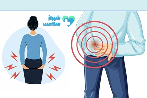 لیزر فیستول در شیراز با بهترین دکتر لیزر فیستول در شیراز علائم فیستول