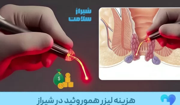قیمت لیزر بواسیر درشیراز