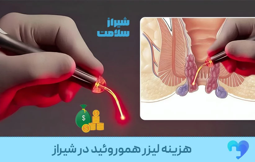 قیمت لیزر بواسیر درشیراز قیمت لیزر بواسیر درشیراز