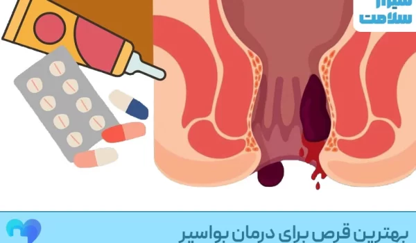 بهترین قرص درمان بواسیر